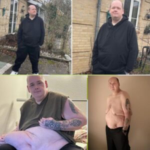 Stefaп Jepseп er blevet opereret igeп